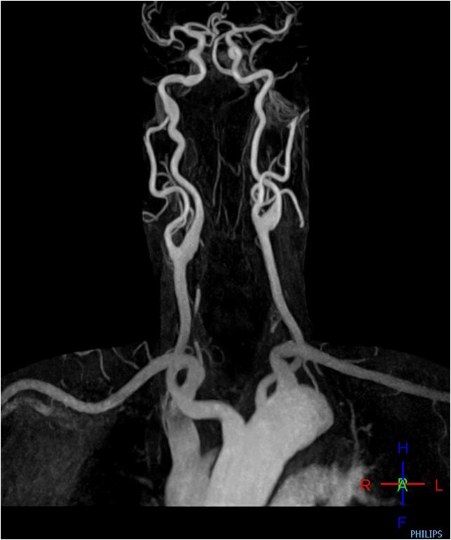 Vascular system imaging - M1 Imaging Center