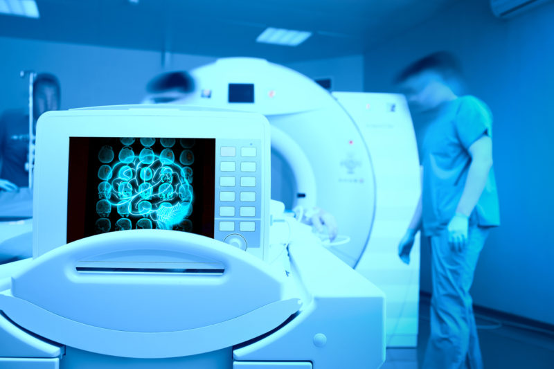 NeuroQuant technology scans for MRI